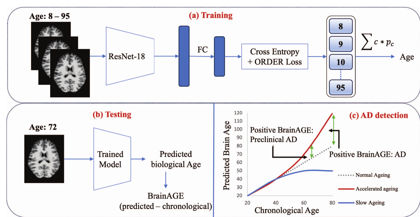 Overview of the brain age prediction framework: training a 3D ResNet-18 with cross-entropy plus ORDER loss on ages 8–95, testing to obtain BrainAGE, and the AD detection trajectory plot