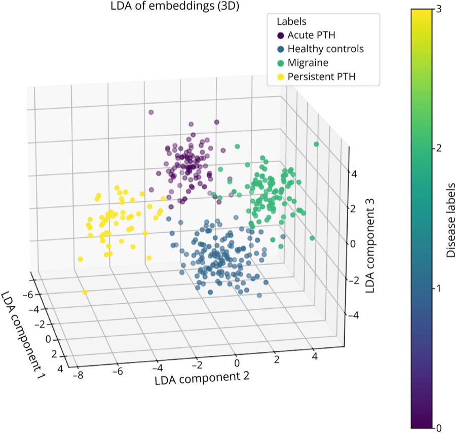 3D LDA projection of penultimate-layer embeddings showing four clusters for healthy controls, acute PTH, migraine and persistent PTH