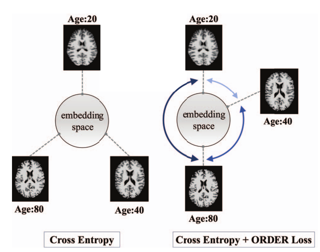 Cartoon of embedding space under cross-entropy versus cross-entropy with ORDER loss, showing scans aged 20, 40 and 80 spaced in proportion to age difference